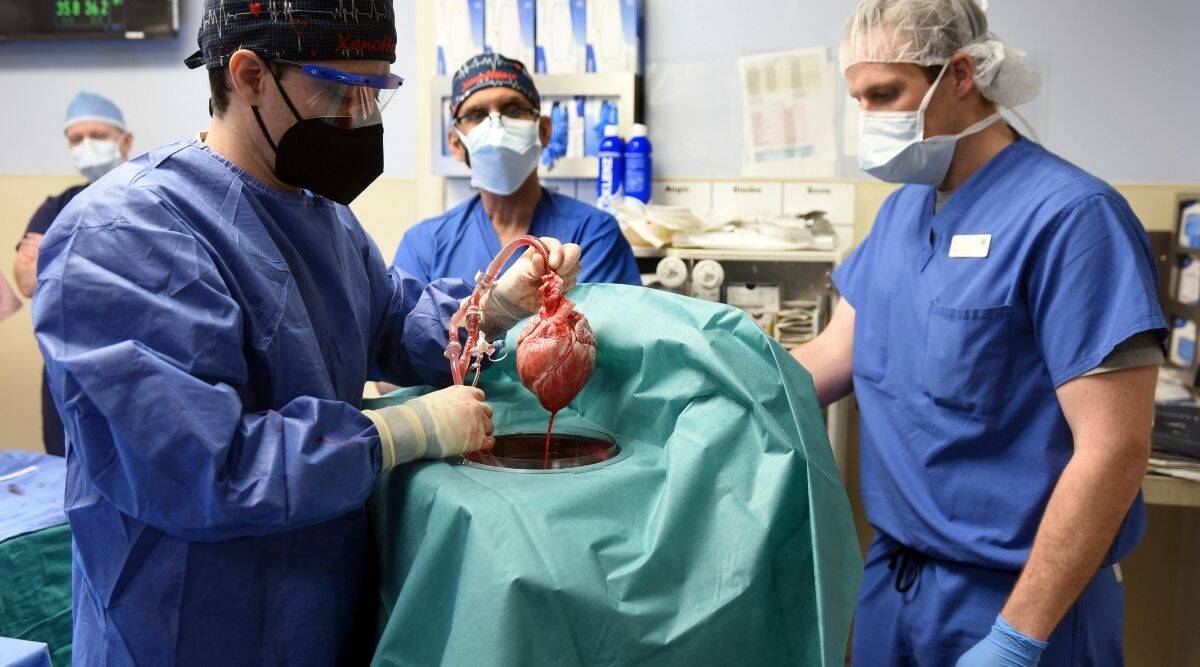 The pig heart which was transplanted into patient David Bennett.