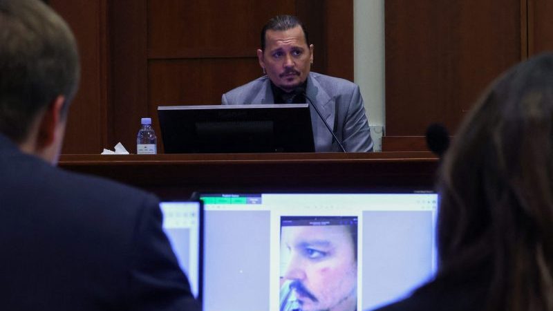 Actor Johnny Depp testifies, as a picture of an injury to his face is seen on a screen, during his defamation trial against his ex-wife Amber Heard. (Photo: REUTERS)
