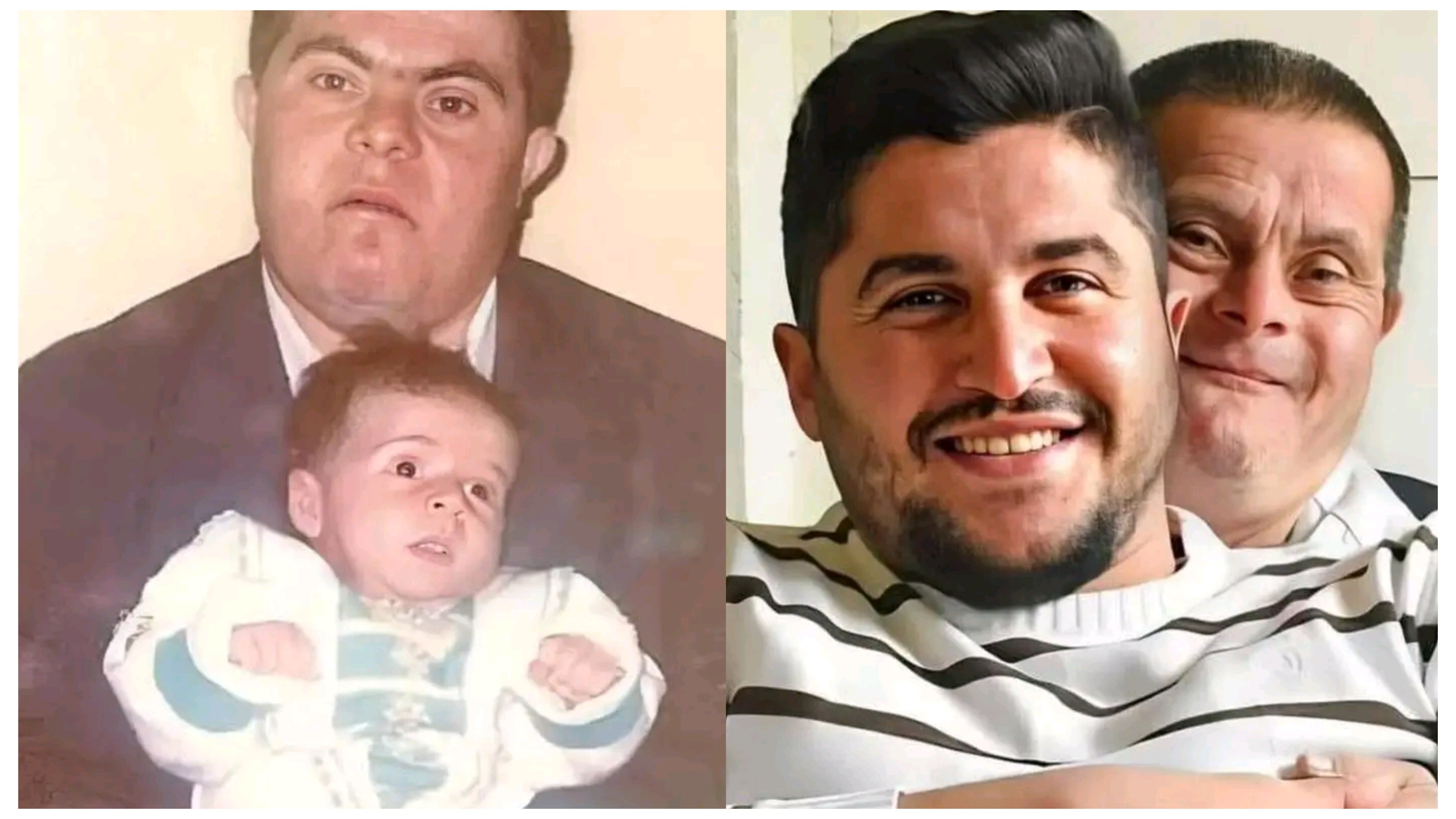 ޑައުން ސިންޑްރޯމް ހުންނަ ބައްޕައަކު ބަލާބޮޑުކުރި ދަރިފުޅު: މިއަދު އެއީ ކާމިޔާބު ޑޮކްޓަރެއް