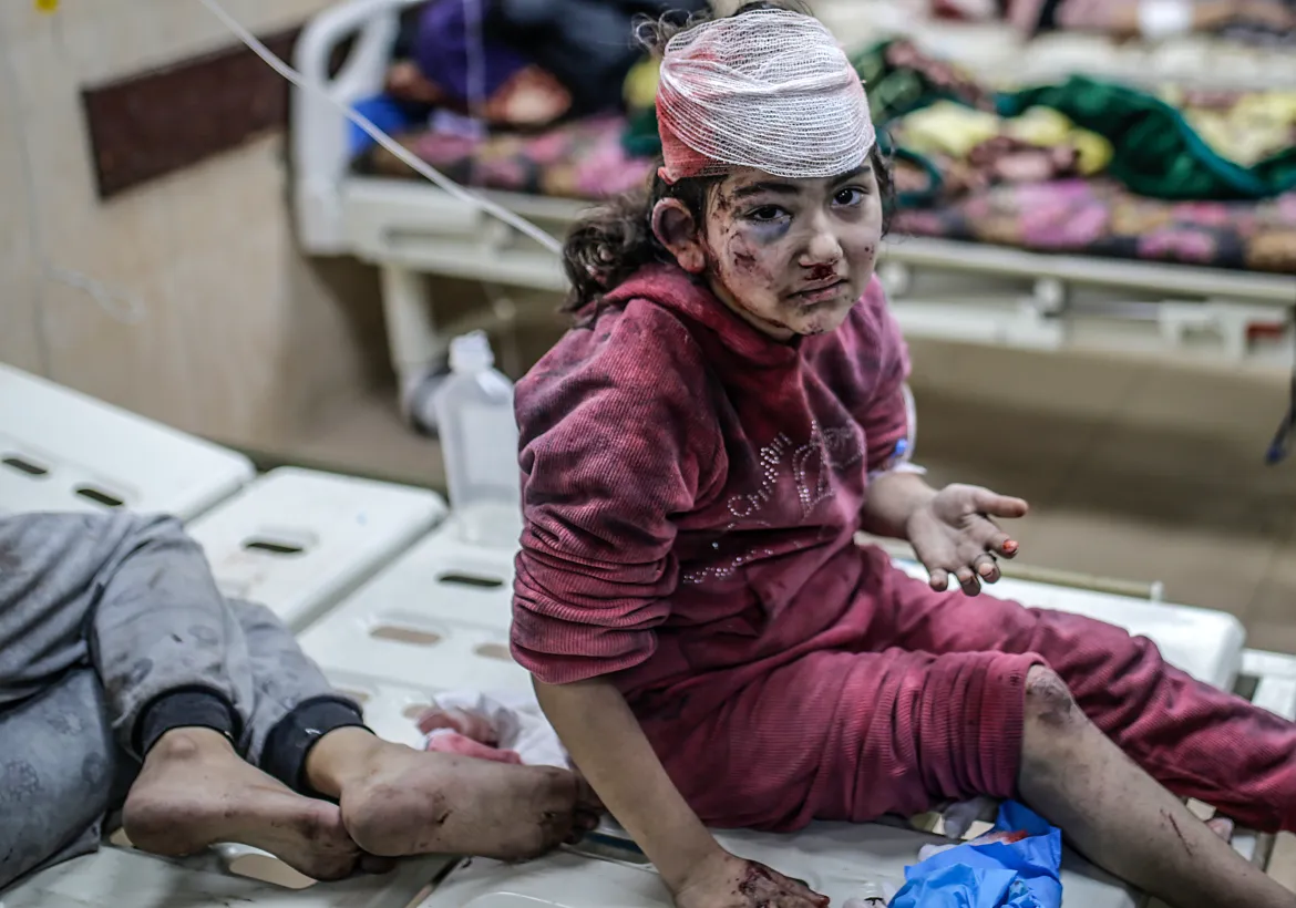 An injured girl sits on a stretcher at the Al-Aqsa Martyrs Hospital in Deir el-Balah. [Mohammed Saber/EPA]